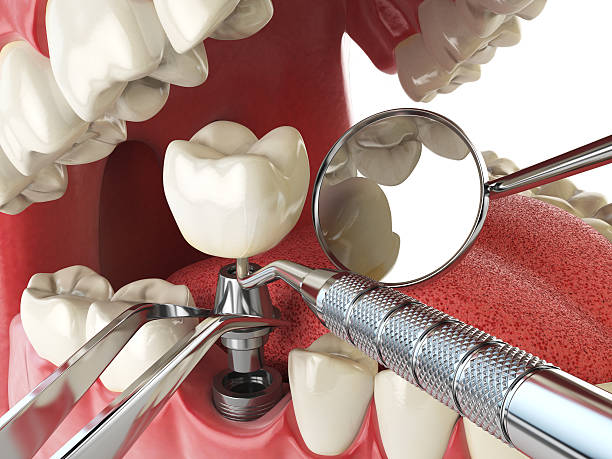 Best Emergency Treatment for Dental Infections or Abscesses in Valdese, NC